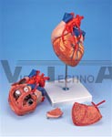 Heart Anatomy with Bypass, 2 times life size, 4 part model